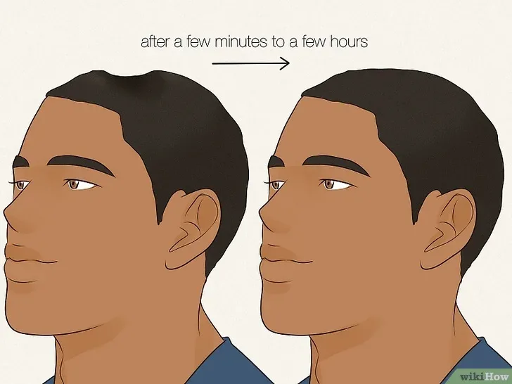 v4 728px Headphone Dent Step 3.jpg